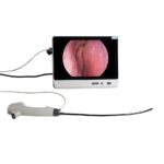 Cistoscopio Flexible Desechable Camjoy