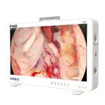 Camjoy CF927 27 Pantalla grande FHD Sistema de cámara endoscopica Visualización quirúrgica FHD 02