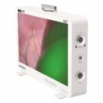 Sistema de cámara endoscopica Camjoy CG932 4K-ICG FPGA de 32 pulgadas 02