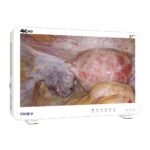 Camjoy CK927 27 4K Ultra HD Sistema de cámara para endoscopio Quirúrgico Claridad 4K 03