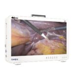 Camjoy CK932 32 Sistema de endoscopia 4K de gran formato Premium Equipo 4K 02