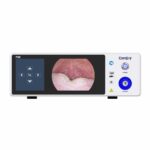 Camjoy Full HD endoscopio FHD 01