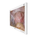Camjoy CF0 24-inch white FHD surgical monitor side view
